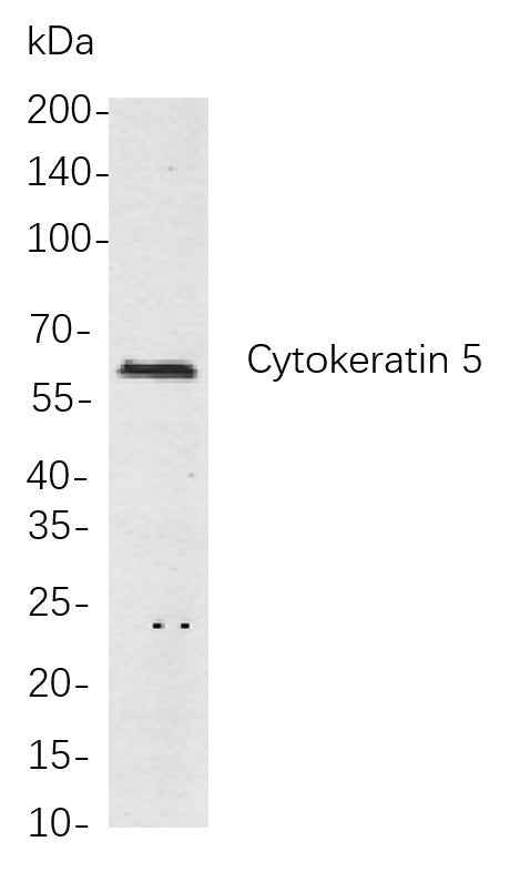 Anti-Human/Mouse/Rat Cytokeratin 5 Antibody [B768] - ABMIUM
