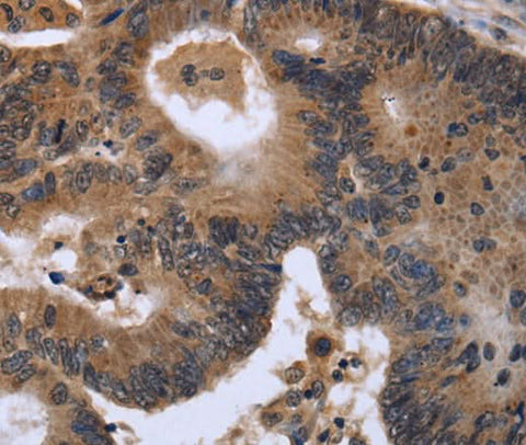 Anti-Human/Mouse FGF21 Antibody - ABMIUM