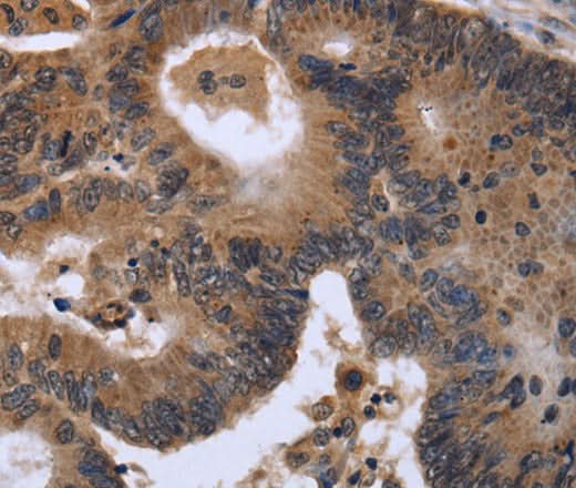 Anti-Human/Mouse FGF21 Antibody - ABMIUM