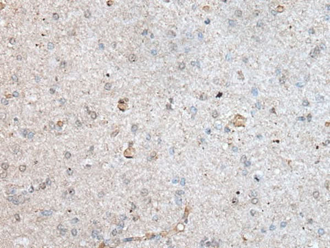 Immunohistochemistry of paraffin-embedded Human brain tissue using RAB4A Polyclonal Antibody at dilution of 1:40(×200)