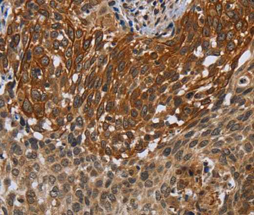Anti-Human/Mouse UHRF2 Antibody
