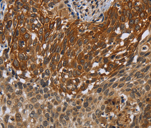 Anti-Human/Mouse UHRF2 Antibody - ABMIUM