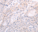 Anti-Human TSHR Antibody - ABMIUM
