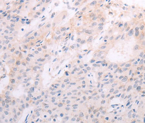 Anti-Human TSHR Antibody - ABMIUM