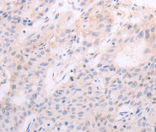 Anti-Human TSHR Antibody - ABMIUM