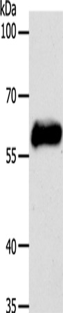 Anti-Human KRT10 Antibody - ABMIUM