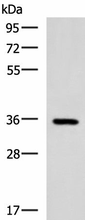 Western blot analysis of Mouse brain tissue lysate using B3GAT1 Polyclonal Antibody at dilution of 1:650