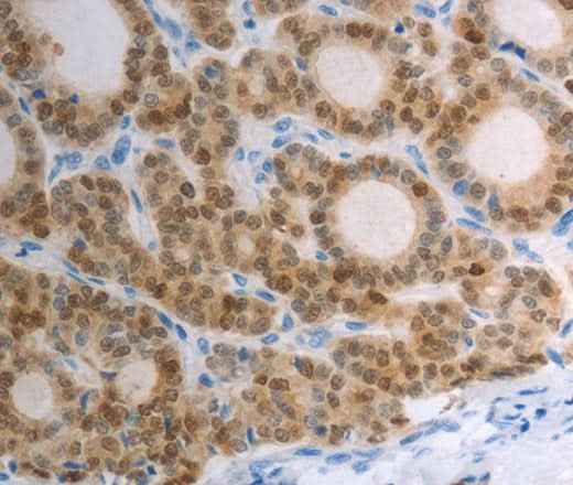 Anti-Human/Mouse/Rat S100A1 Antibody