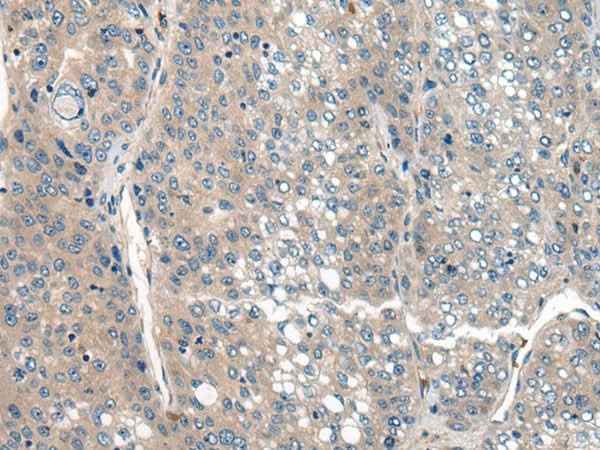 Anti-Human CLTCL1 Antibody