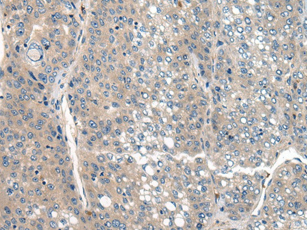 Anti-Human CLTCL1 Antibody - ABMIUM