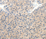 Anti-Human SCN10A Antibody - ABMIUM