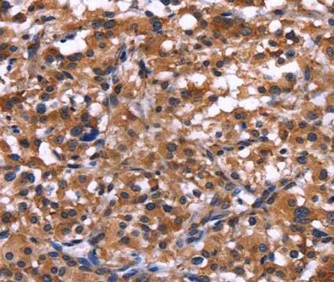 Anti-Human IL1A Antibody