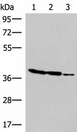 Western blot analysis of HT-29 K562 and HUVEC cell lysates using GIMAP2 Polyclonal Antibody at dilution of 1:1000