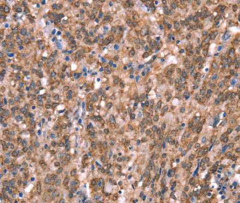 Anti-Human GCSAM Antibody