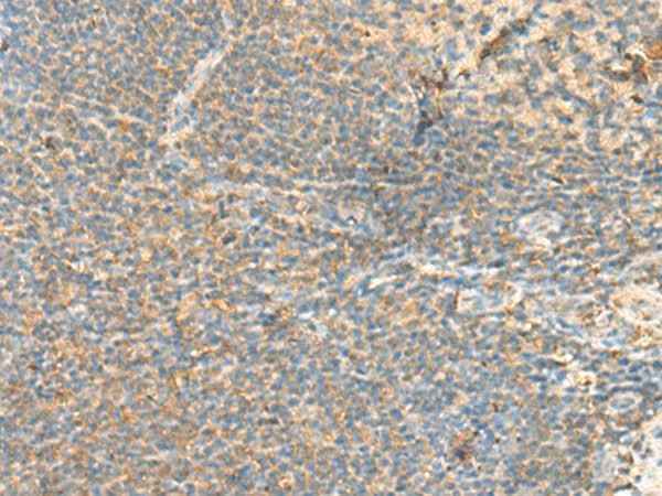 Anti-Human/Mouse RHOH Antibody