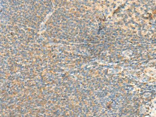 Anti-Human/Mouse RHOH Antibody