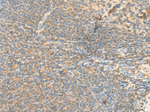 Immunohistochemistry of paraffin-embedded Human tonsil tissue using RHOH Polyclonal Antibody at dilution of 1:90(×200)