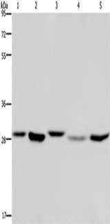 Anti-Human/Mouse/Rat ECHS1 Antibody - ABMIUM
