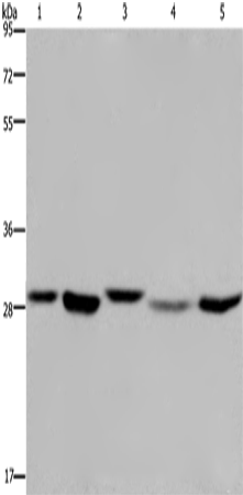 Anti-Human/Mouse/Rat ECHS1 Antibody - ABMIUM