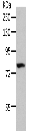 Anti-Human/Mouse/Rat CD10 Antibody - ABMIUM
