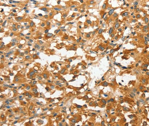 Anti-Human ANXA9 Antibody - ABMIUM