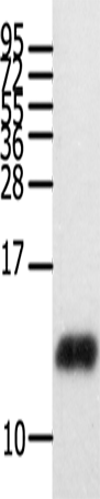 Anti-Human CCL28 Antibody - ABMIUM