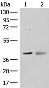 Western blot analysis of Mouse kidney tissue and Human fetal brain tissue lysates using ADH5 Polyclonal Antibody at dilution of 1:500