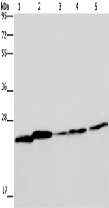 Anti-Human/Mouse/Rat ARHGDIA Antibody - ABMIUM