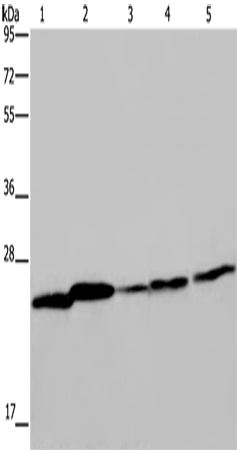 Anti-Human/Mouse/Rat ARHGDIA Antibody - ABMIUM