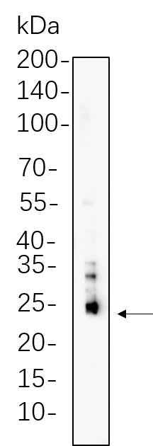Anti-Human/Mouse/Rat Bim Antibody [B755] - ABMIUM