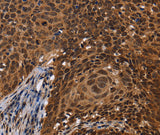 Anti-Human FASTKD5 Antibody - ABMIUM