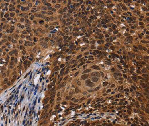 Anti-Human FASTKD5 Antibody