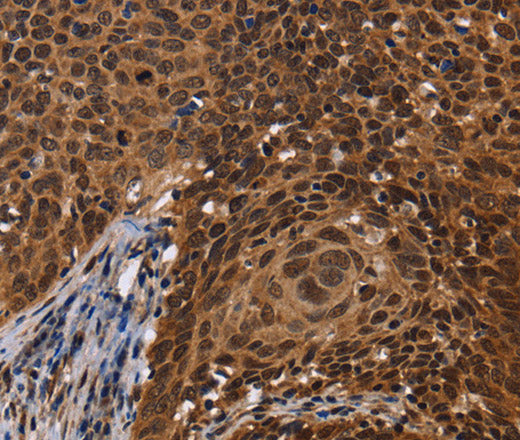 Anti-Human FASTKD5 Antibody - ABMIUM