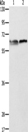 Anti-Human/Mouse/Rat ALAS2 Antibody - ABMIUM
