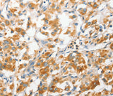 Anti-Human/Mouse ANAPC2 Antibody - ABMIUM