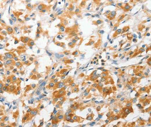 Anti-Human/Mouse ANAPC2 Antibody