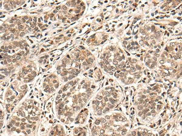 Anti-Human HGH1 Antibody