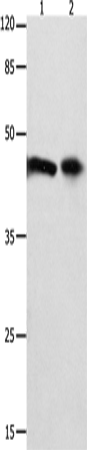 Anti-Human/Mouse FOXL1 Antibody - ABMIUM