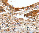 Anti-Human/Mouse/Rat COL1A2 Antibody - ABMIUM