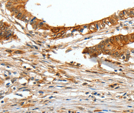 Anti-Human/Mouse/Rat COL1A2 Antibody - ABMIUM