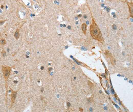 Anti-Human NOL3 Antibody