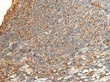 Immunohistochemistry of paraffin-embedded Human tonsil tissue using GPSM2 Polyclonal Antibody at dilution of 1:65(×200)