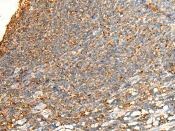 Anti-Human/Mouse GPSM2 Antibody