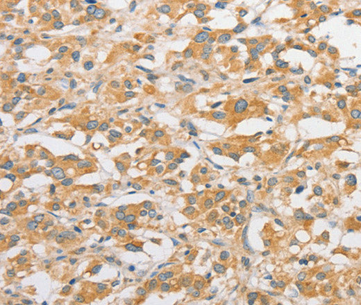 Anti-Human TLR5 Antibody - ABMIUM