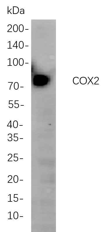 Anti-Human/Mouse/Rat COX2 Antibody [B794] - ABMIUM