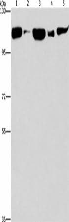 Anti-Human/Mouse/Rat DNM2 Antibody - ABMIUM