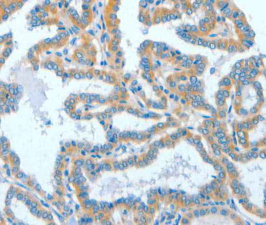 Anti-Human/Mouse ASCC1 Antibody