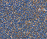 Anti-Human CARD6 Antibody - ABMIUM