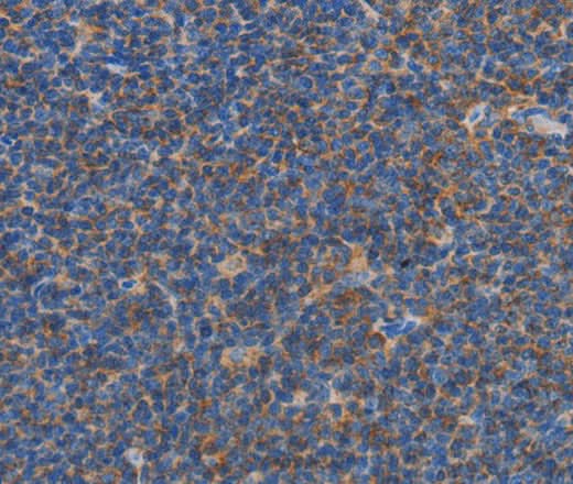 Anti-Human CARD6 Antibody - ABMIUM