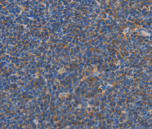 Anti-Human CARD6 Antibody - ABMIUM